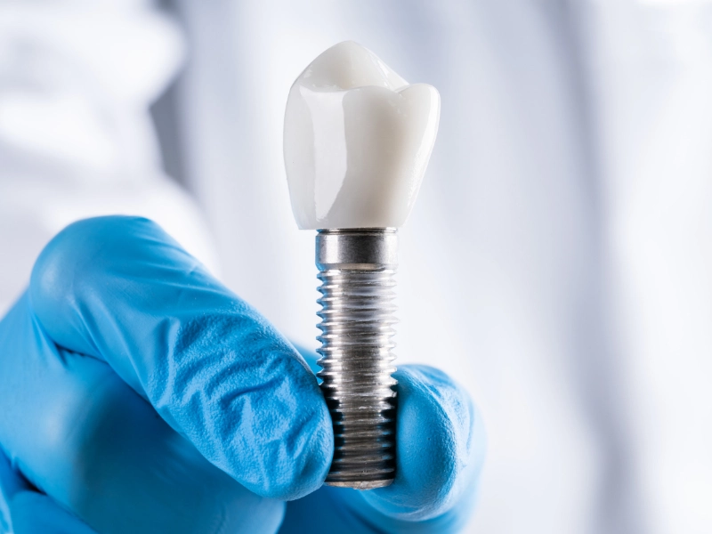 Blog 7 implant sonrasi agri olur mu